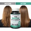 Biotin Plus Zinc Tablets for Hair Growth – Hair Skin & Nails