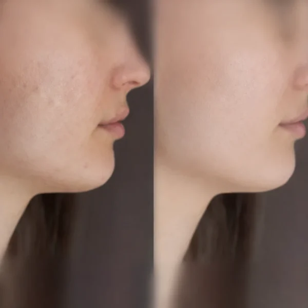 Chewy-C Vitamin C Plus Golex L-Glutathione Tablets Combo