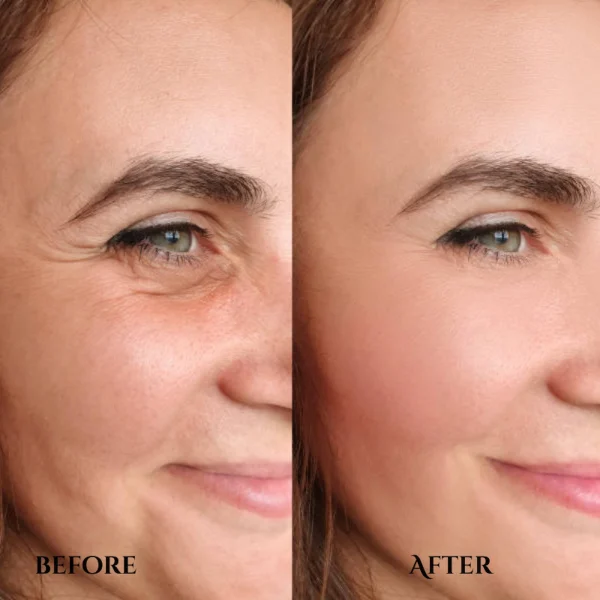 Glogen Whitening Serum